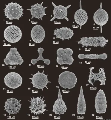  Heterolokomix! A Single-Celled Creature With A Thousand Hats (and Feet!)